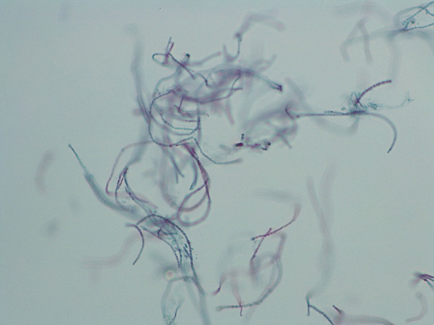 Anabaena Slides - Anabaena 04 100X